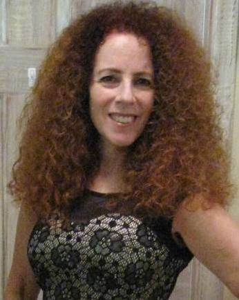 Carol Ruth Weber after Vampiresque treatment