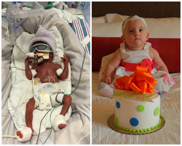 Photos Of Premature Babies Then And Now Show Their Incredible Journey