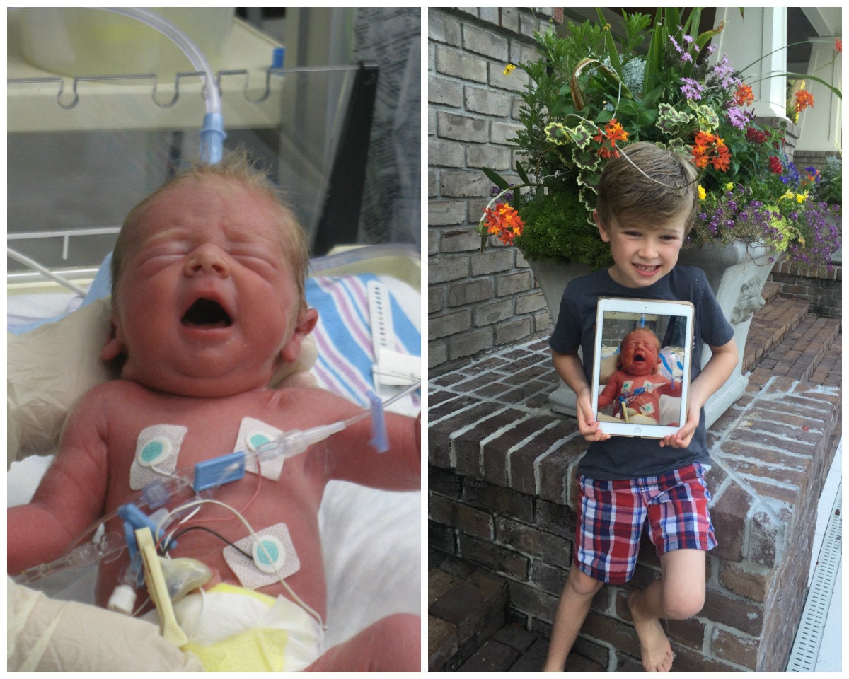 7 week old premature baby development