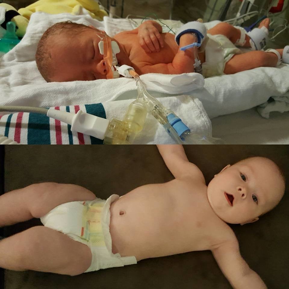 27 week old preemie