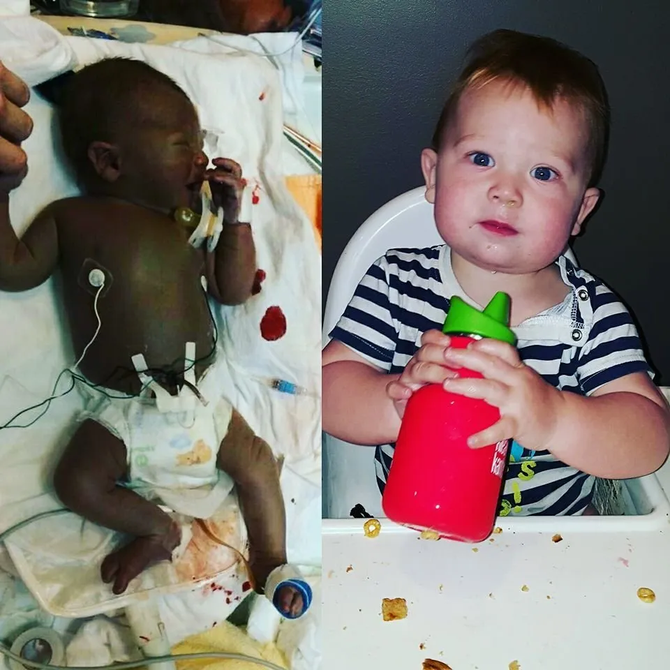 Photos Of Premature Babies Then And Now Show Their Incredible Journey Huffpost Life