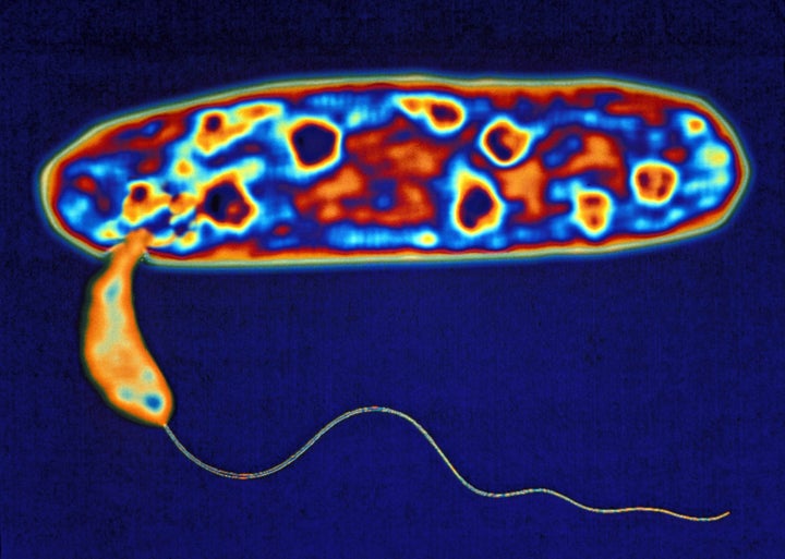 Bdellovibrio enters a larger bacterium.