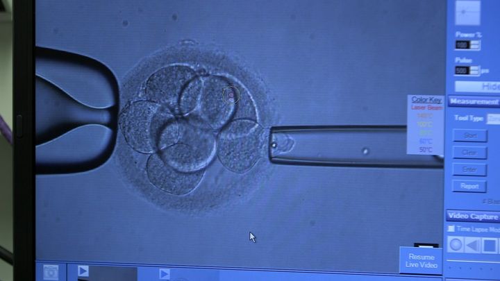 An embryo undergoing genetic screening 