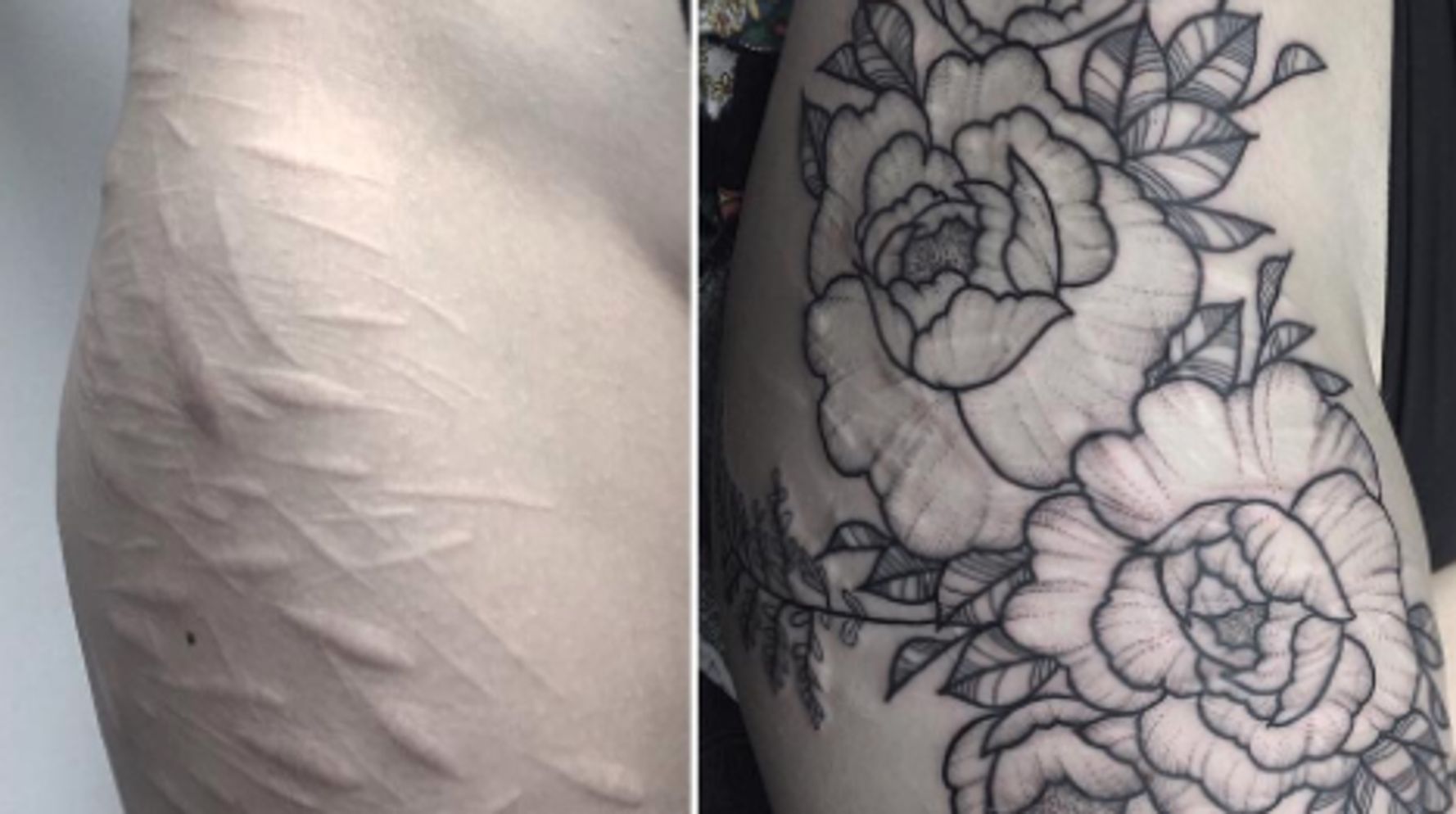 Over harm scars self tattoo Tattoo artist