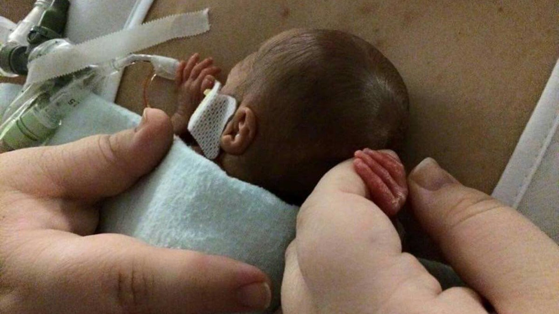 77 Emotional Photos Of Preemie Parents With Their Babies In 77 Emotional Photos Of Preemie Parents With Their Babies In