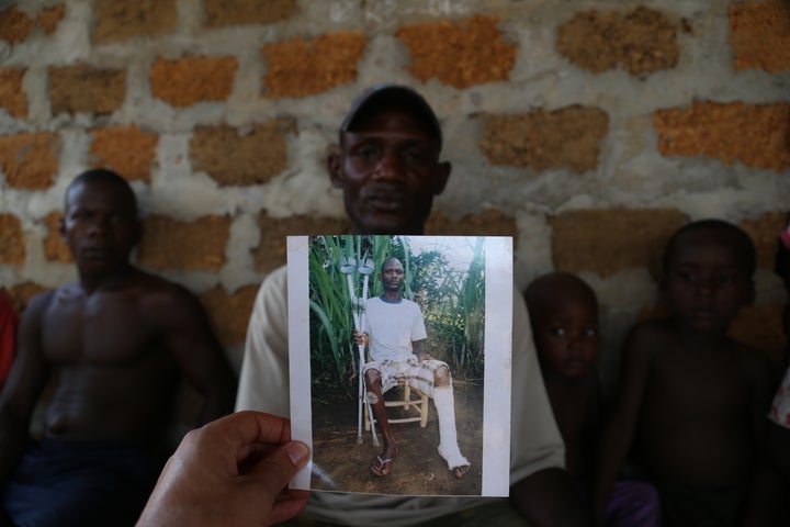 <p>Injured worker with a photo of his injuries</p>