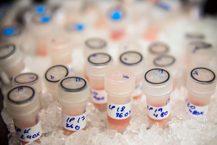 Vials containing biological samples are stored on ice to keep them fresh before being analysed to see how they are affected by chemotherapy drugs at the Cancer Research UK Cambridge Institute on December 9, 2014 in Cambridge, England.
