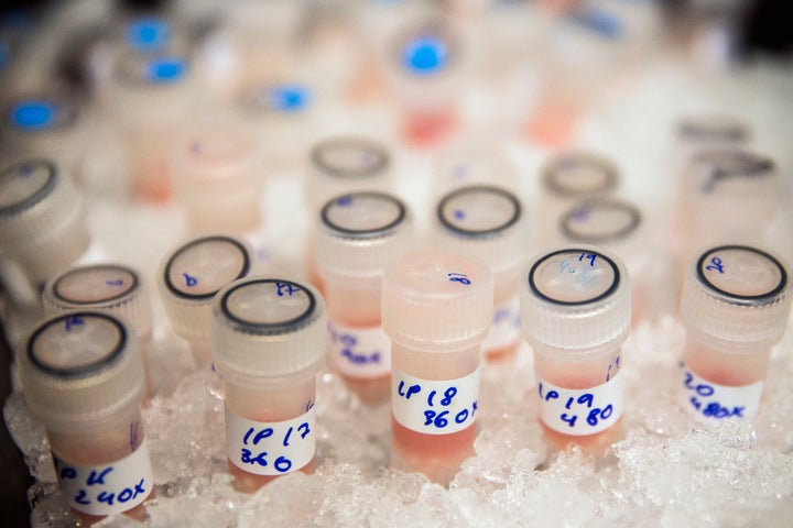 Vials containing biological samples are stored on ice to keep them fresh before being analysed to see how they are affected b