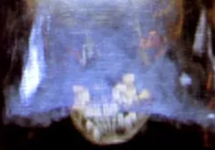 <p>3D volumetric rendering of an Egyptian mummy.</p>