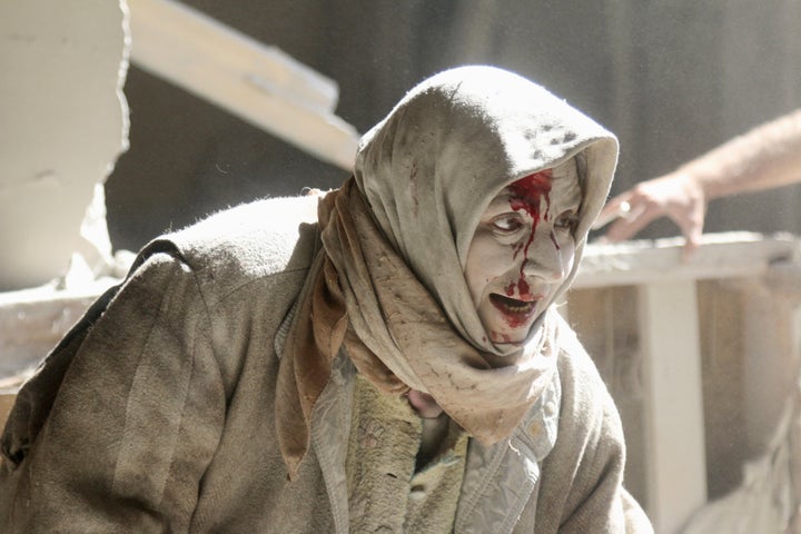 A woman who was injured during the siege of Aleppo.