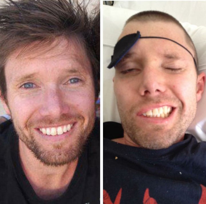 Ryan before having a stroke, in 2011, and after, in September 2012.