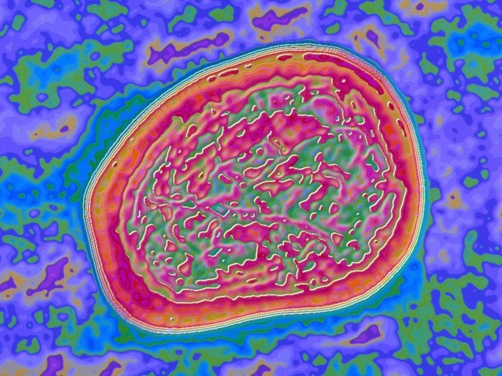 <p>Computer-digitized image of a mumps virus.</p>