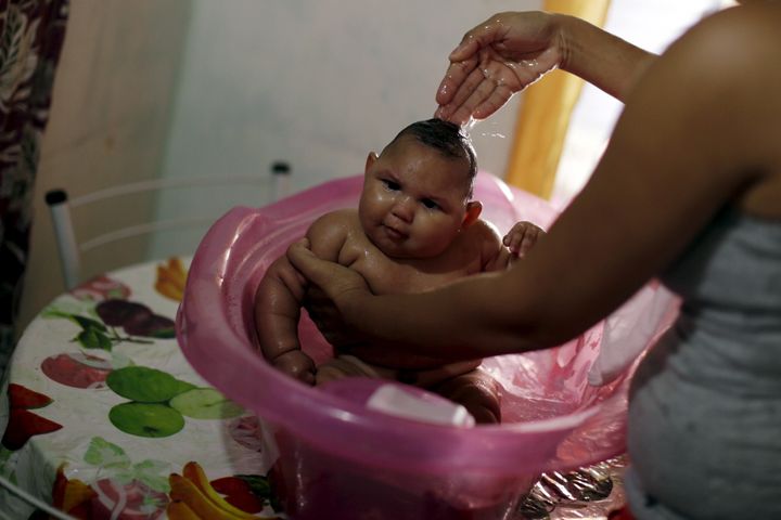 Gleyse Kelly da Silva bathes her daughter Maria Giovanna, who has microcephaly, at their house in Recife, Brazil, January 30, 2016.
