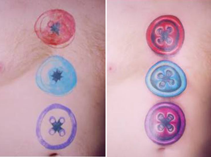 Ginge's button tattoos before (left) and after (right) the Tattoo Fixers upgrade