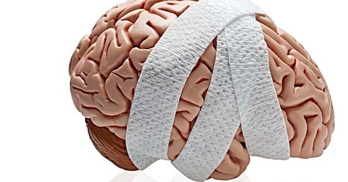 What You Should Know About Concussions Huffpost Life 