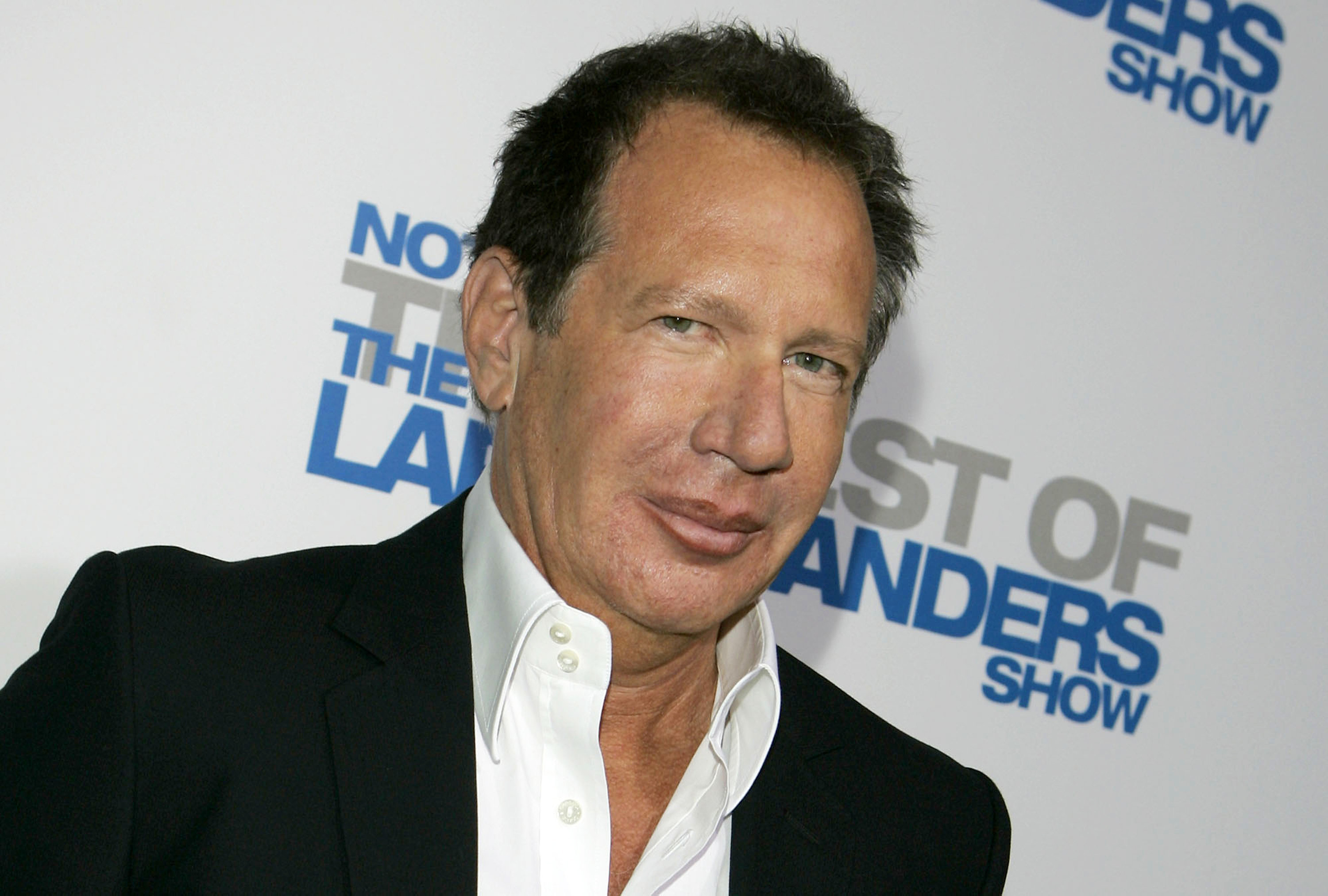 Garry Shandling Died Of A Blood Clot According To Autopsy Report   5862958f150000230091600f 