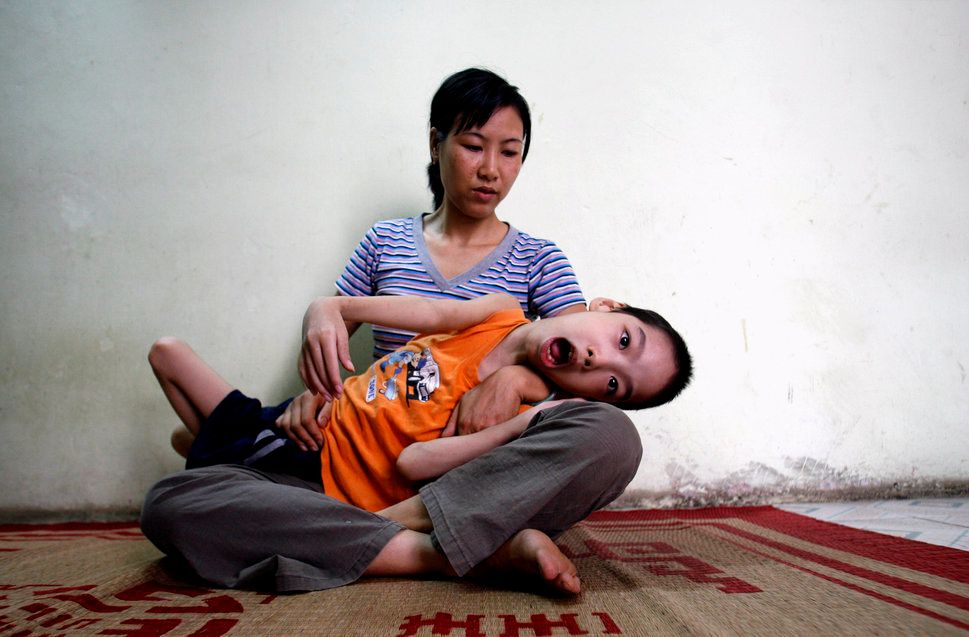 Pham Duc Duy is cradled in the arms of his mother in Hanoi in 2007. Vietnamese doctors believe Duy, whose grandfather served in the Vietnam War, is a victim of exposure to dioxin passed down the generations.