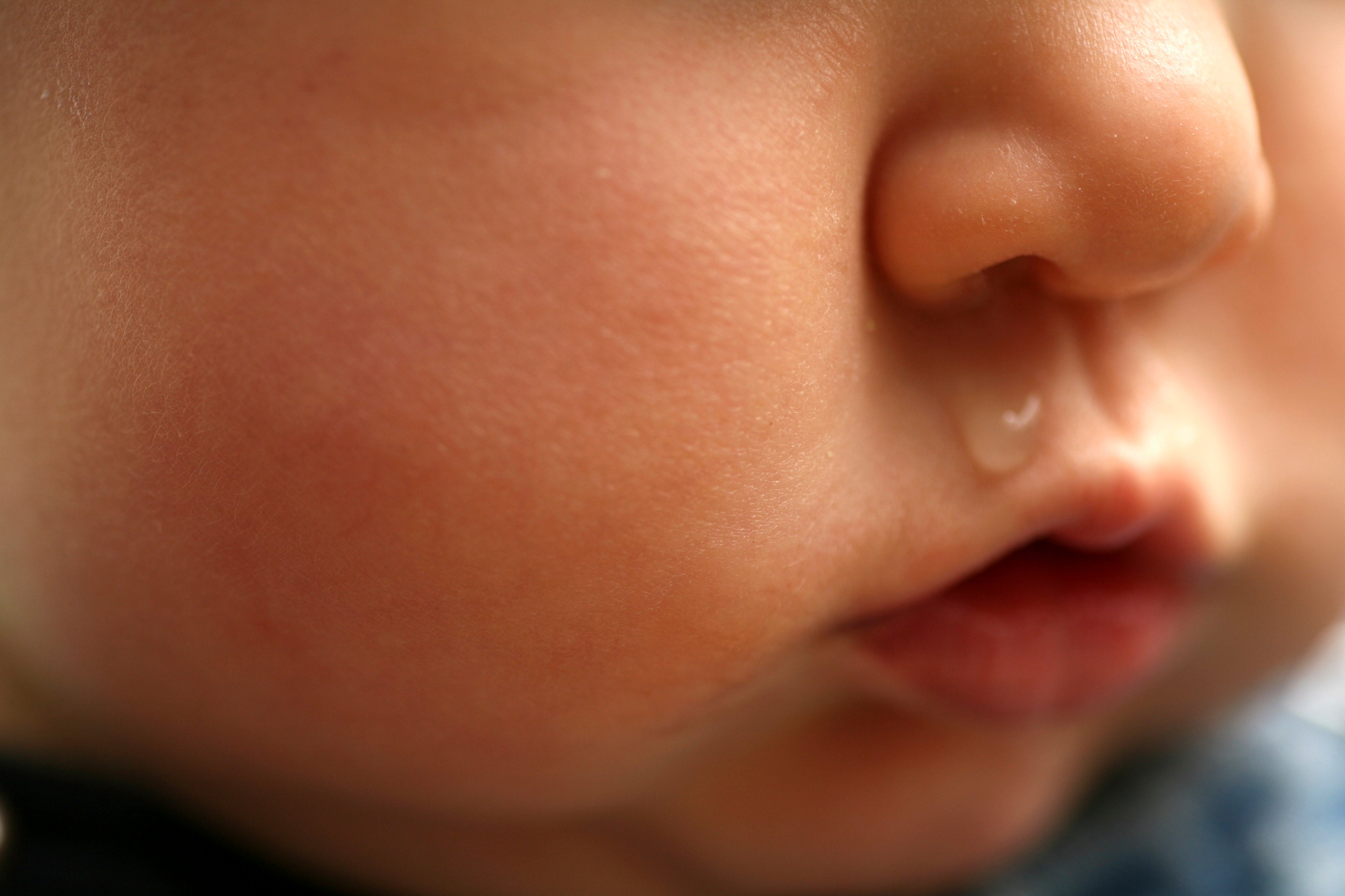 baby cold nose