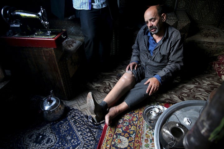 Shahrour, 54, whose leg was amputated due to complications from diabetes, sits in his home in the besieged town of Arbeen, in