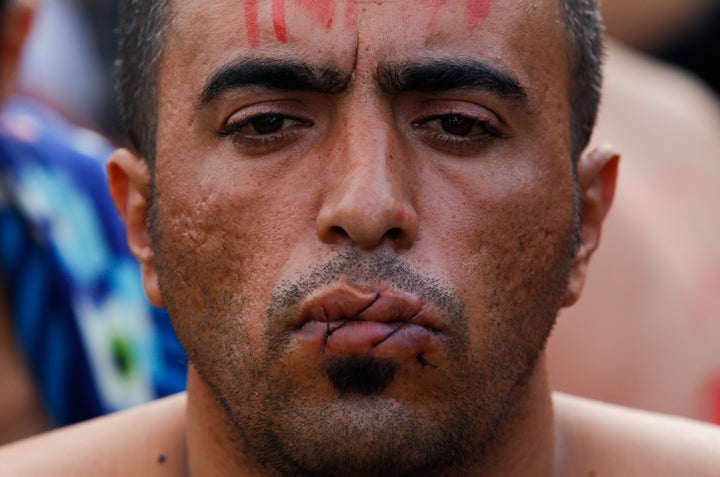 A migrant with his mouth sewn shut in protest sits at the border with Greece near the village of Gevgelija, Macedonia Novembe