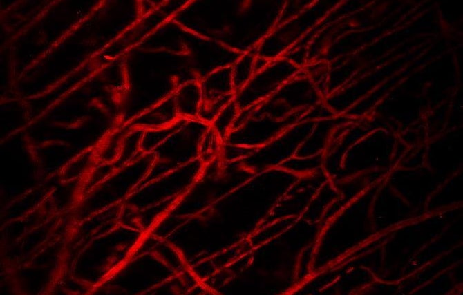 Vascular structure in healthy tissue evaluated by intravital microscopy 