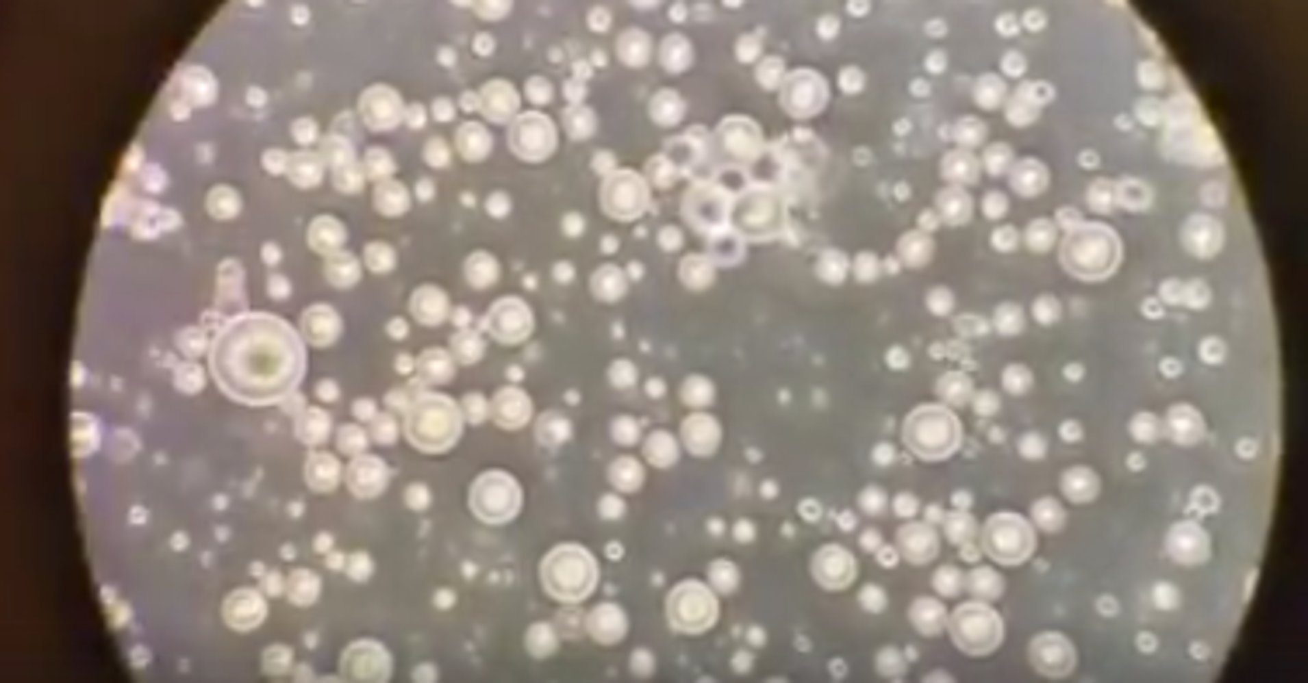 People Are Fascinated By This Video Of Breast Milk Under A Microscope HuffPost