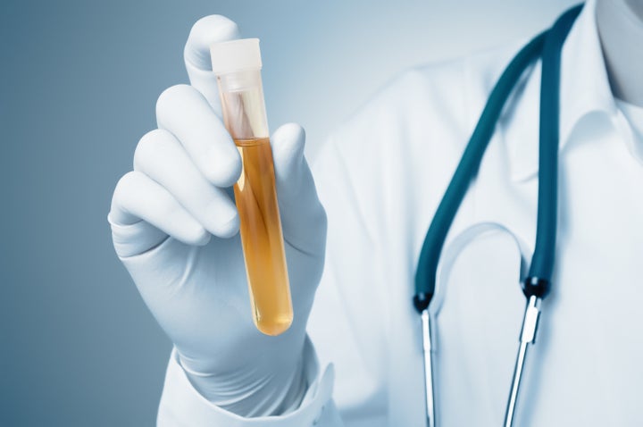 There's a popular notion that urine is sterile, but recent research suggests that's not true.