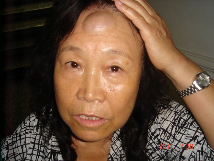 Huuchinhuu after being beaten during her clandestine imprisonment.