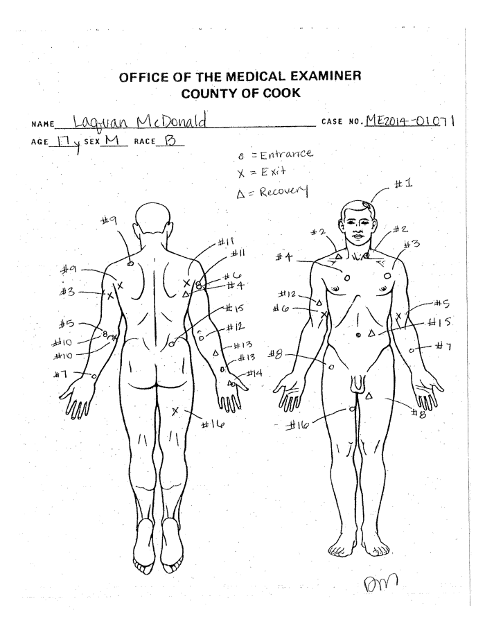 A portion of Laquan McDonald's autopsy report shows the black teenager, killed by a Chicago police officer, was shot 16 times. McDonald was walking away from police as he was shot. 