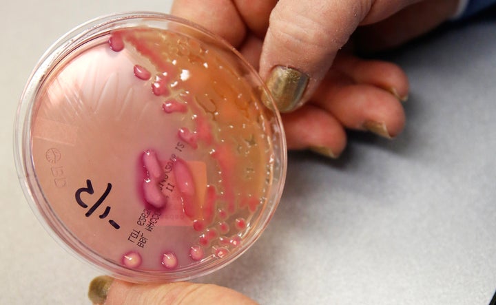 The Klebsiella pneumoniae organism in a petri dish.