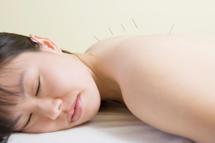 Acupuncture has a long history of effectiveness for the treatment of pain, general health concerns and menopausal symptoms.
