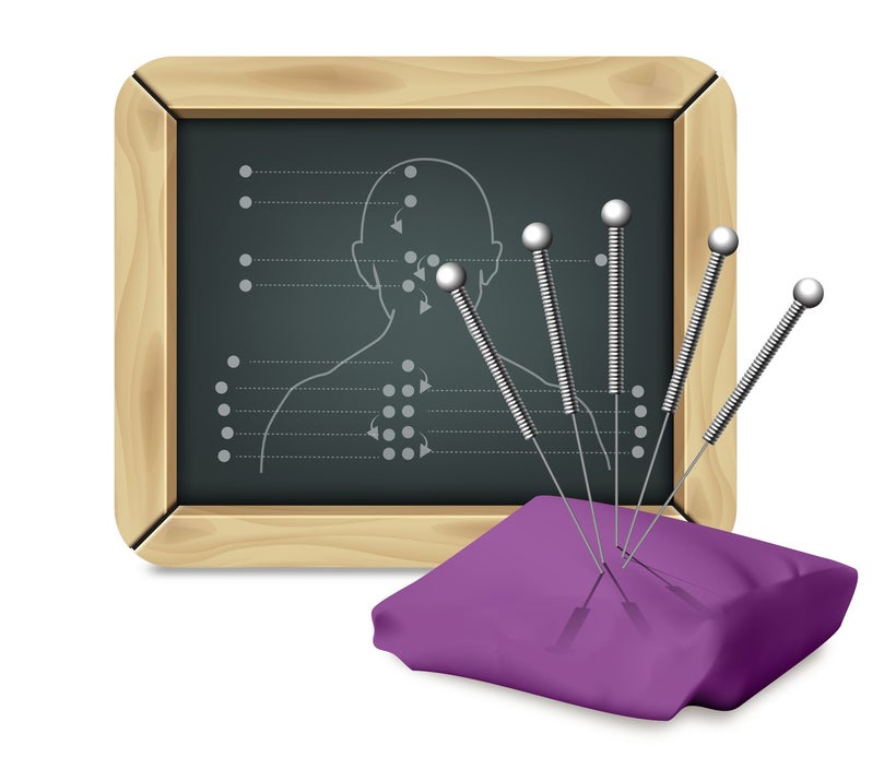 According to Traditional Chinese Medicine, the use of acupuncture needles can influence the body’s energy along meridians whi