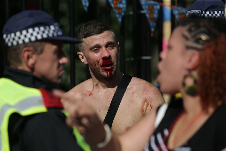 The 2016 carnival resulted in 450 arrests in 2016 - 151 people were charged with violent crimes; a man with a bloodied face is pictured speaking with police at the 2016 festival
