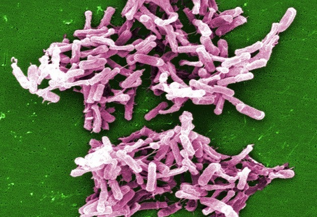 <p>A cluster of clostridium difficile bacteria</p>