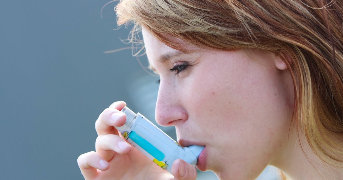 Бронхиальная астма симптомы. Астма прошла. Данные анамнеза при бронхиальной астме. Астма прошла. Тяжелая астма.