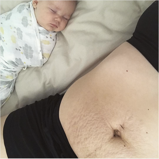 Kristelle Morgan of Australia wants to remind moms to be "kinder to themselves" about their bodies.