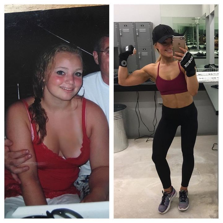 Alice Liveing before (left) and after (right) losing weight. 