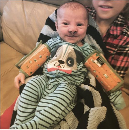 At 24 weeks, Sara Heller and her partner learned their son Brody had a bilateral cleft lip and palate.