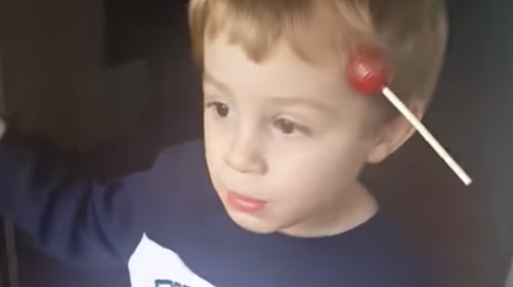 Lollipop Stuck to Head: Causes, Safety, and How to Remove It