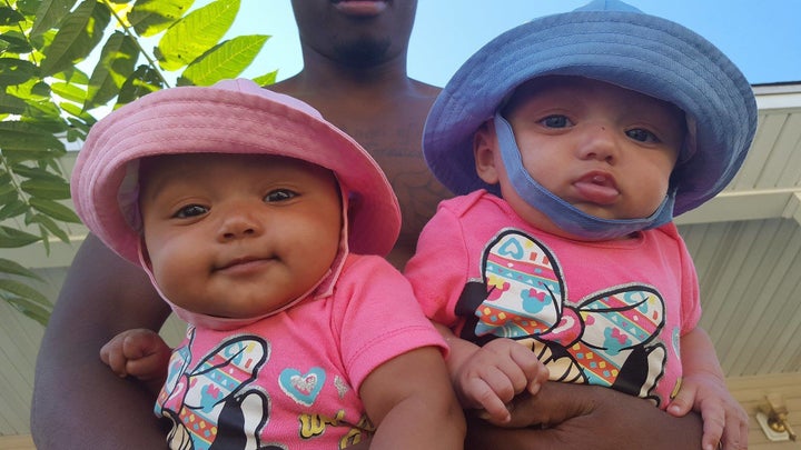 Jarani, left, received her father’s darker skin and brown eyes, while Kalani, right, received her mother’s light skin and blue eyes. 