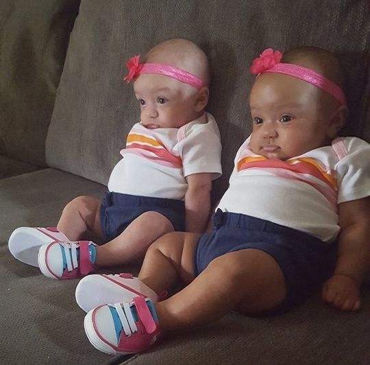skin different twins colors born two color meyer whitney girls biracial twin adorable were these