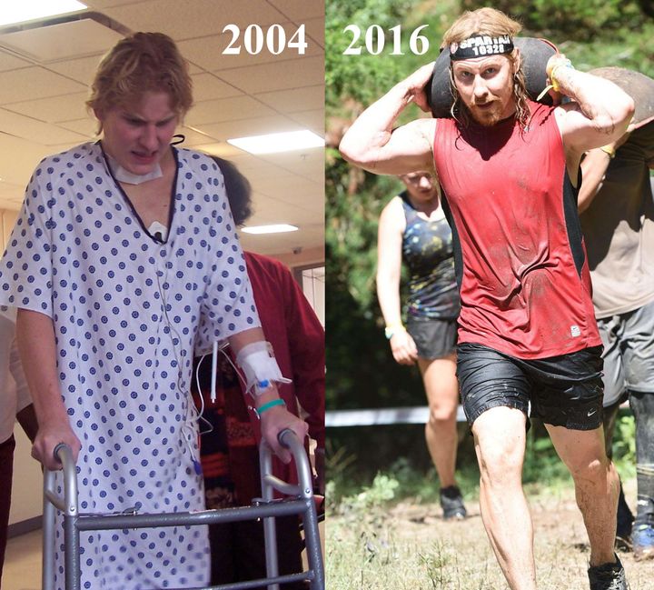 Left: Relearning how to stand in 2004. Right: My first Spartan Race in 2016
