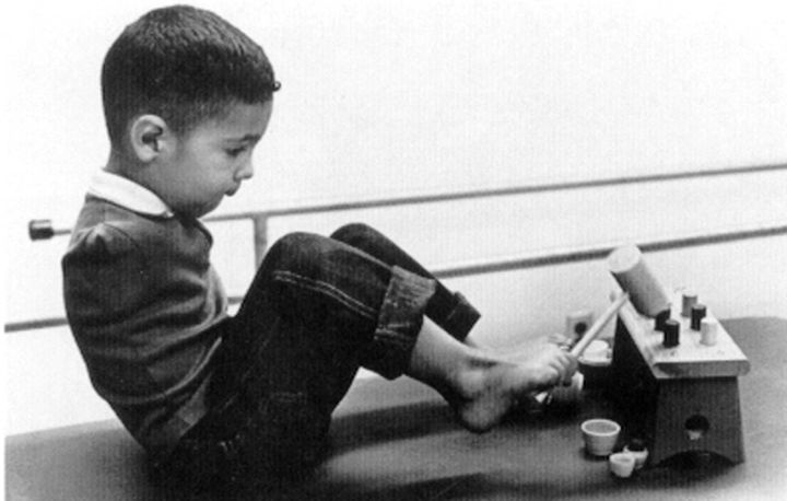 Thalidomide victim Tony Melendez is shown in an undated file photo at age 4. Melendez, who lives in Dallas, is one of a few thousand people around the world living with the birth defects caused by thalidomide.