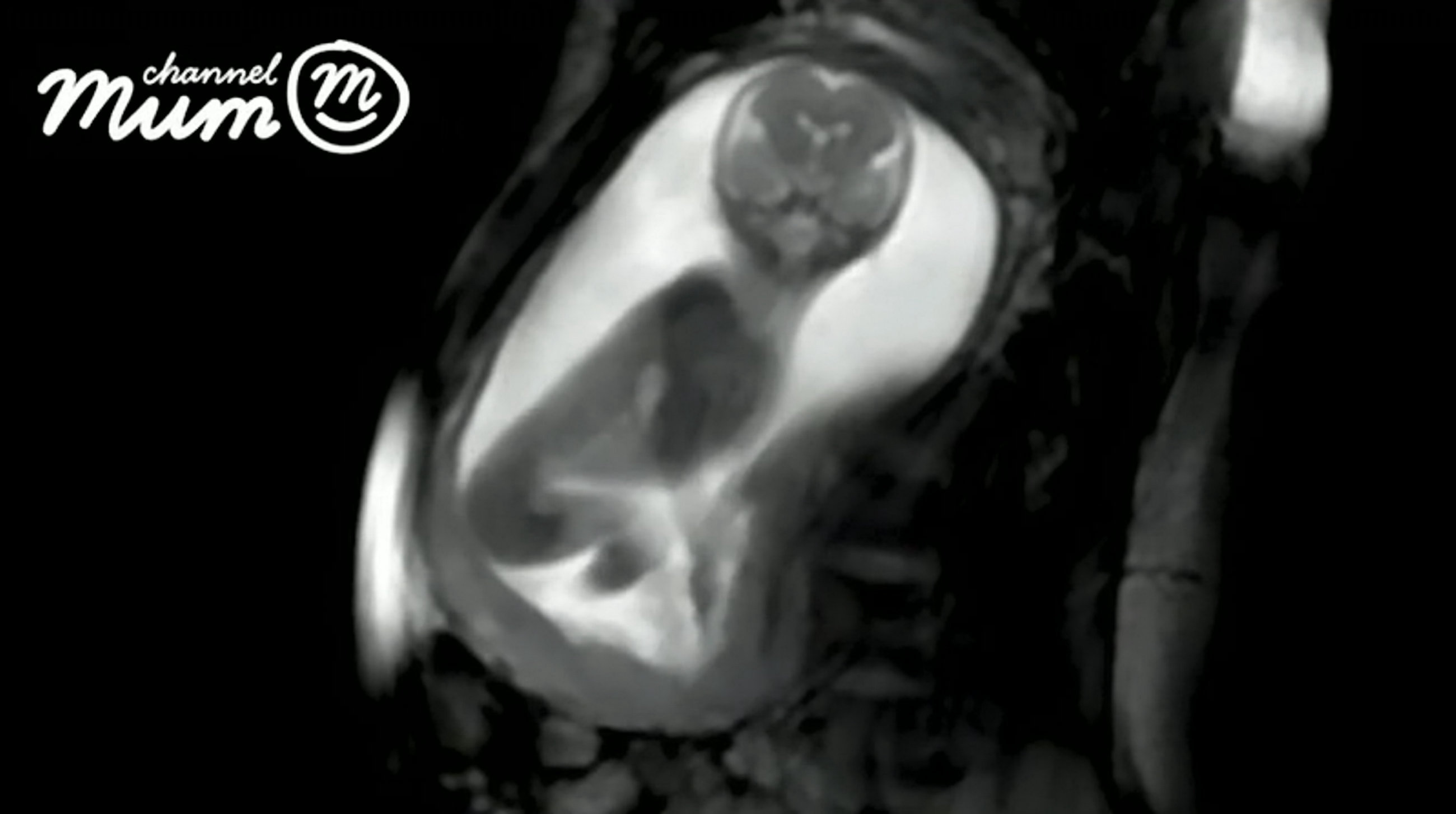 'Next Level Baby Bump Scans' Show Baby Moving And Kicking In Womb Using ...