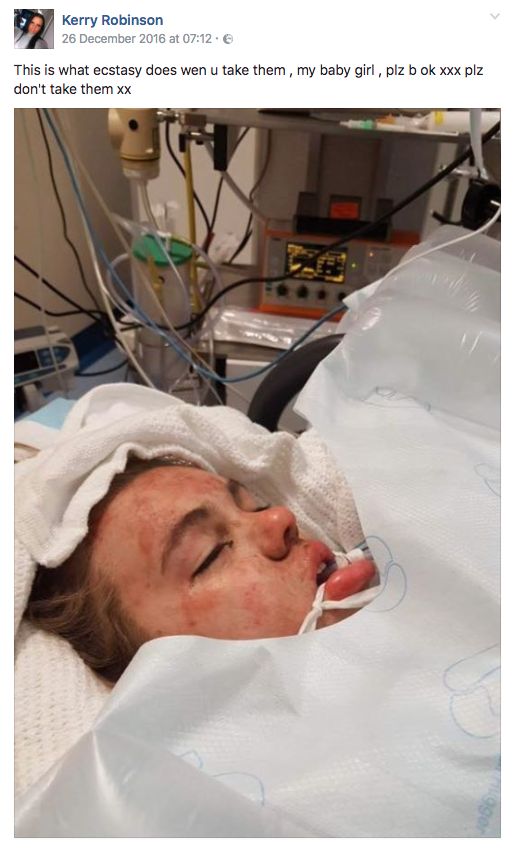 Photos of 16-year-old Leah Robinson in a coma after taking ecstasy went viral when her mum shared them online 