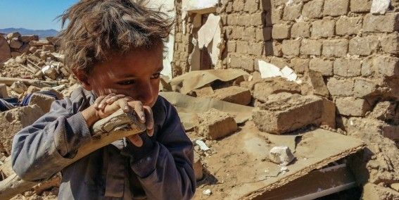 <p>Children are suffering the most from Yemen’s war and hunger crisis. Food shortages are putting them at extreme risk of deadly malnutrition.</p>