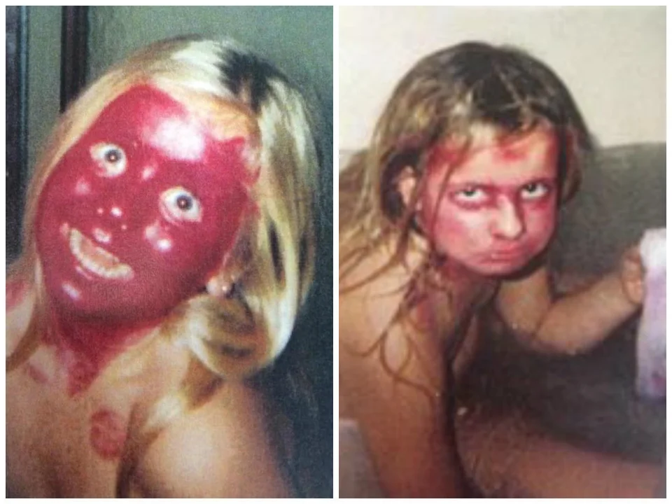 kinderen