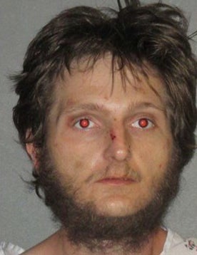Thomas Bennett, 28, is accused of repeatedly striking a Baton Rouge police officer over the head with his own baton.