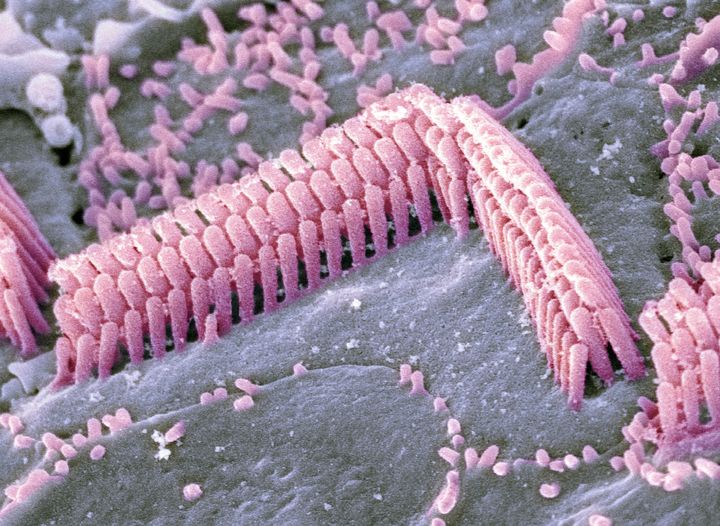 Inner ear hair cells. Coloured scanning electron micrograph (SEM) of sensory hair cells from the organ of Corti, in the cochlea of a mammalian inner ear.