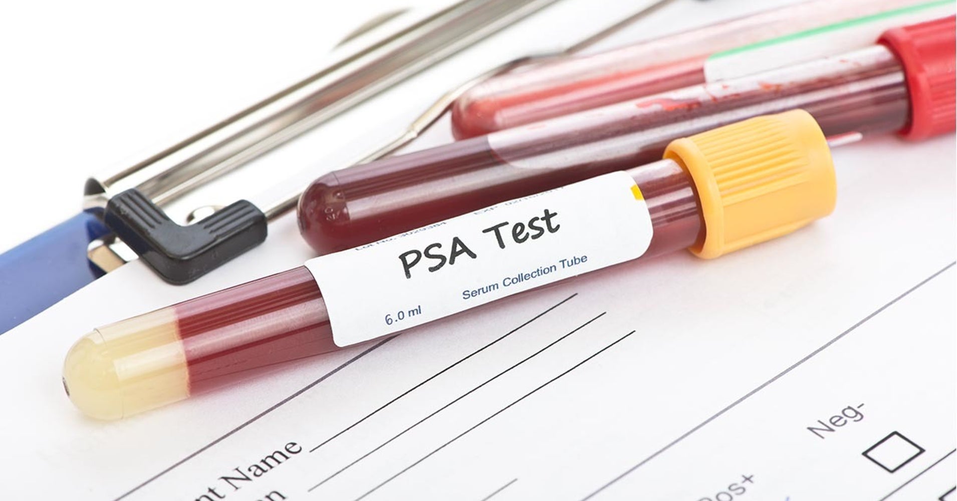 What Does Elevated Psa Test Mean